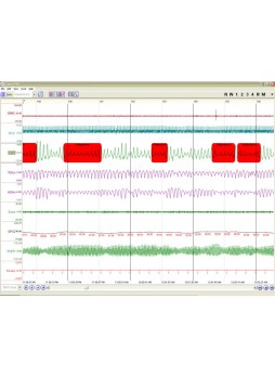 Полисомнограф с EEG SleepScout™