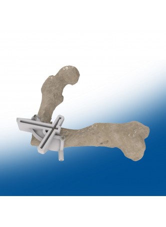 Анатомическая модель бедренная кость