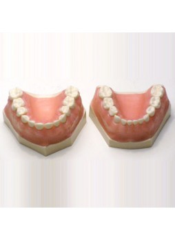 Анатомическая модель прорезывание зубов EK1