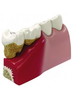 Анатомическая модель зуб 2860