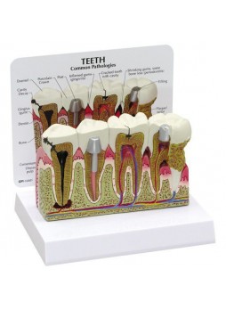 Анатомическая модель зуб 2860