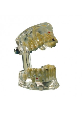 Анатомическая модель прорезывание зубов 355643 оптом