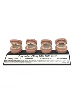 Анатомическая модель прорезывание зубов 79212
