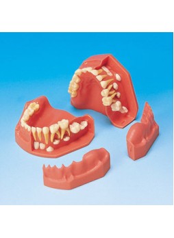 Анатомическая модель прорезывание зубов PE-PDI004