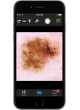 Дерматоскоп белый светодиод VEOS HD1