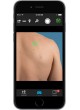Дерматоскоп белый светодиод VEOS HD1