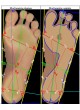 Компьютеризованный подоскоп 3D PODOSCANALYZER оптом