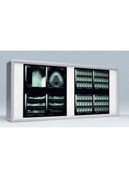 Негатоскоп 2 диапазона XBF001