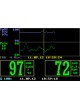 Портативный пульсовой оксиметр sat 801+ оптом
