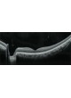 Ретинальная камера Retina Scan Duo™ оптом