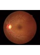 Ретинальная камера Retina Scan Duo™ оптом