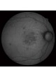 Ретинальная камера Retina Scan Duo™ оптом