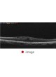 Ретинальная камера Retina Scan Duo™ оптом