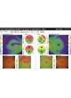 Ретинальная камера Retina Scan Duo™ оптом