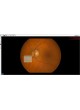 Немидриатическая ретинальная камера COBRA+ оптом