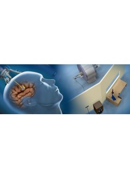 Устройство для лазерной абляции для лечения опухолей мозга NeuroBlate®