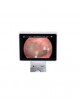 Камера для эндоскопов AMD-2700 оптом
