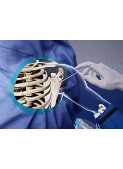 Моделирующее устройство для ортопедической хирургии
