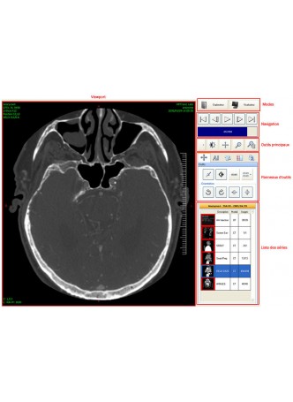 Программное обеспечение DICOM-файла Ultima Digital Illuminator оптом