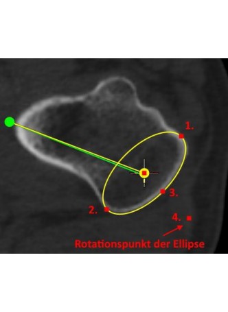 Программное обеспечение для диагностических мониторов mediCAD 3D Knee Sport