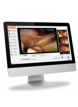 Программное обеспечение для медицинских снимков Zscan Plus