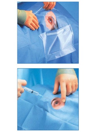 1061 Средняя офтальмологическая простыня с разрезаемой пленкой ЗМ™ Steri-Drape™ и карманом оптом