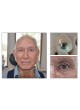 Эстетический протез для глаз RealLifeEye™ оптом