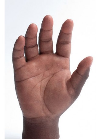 Эстетический протез рука livingskin™ оптом