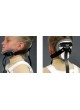 Шейно-грудной-пояснично-крестцовый поддерживающий корсет Flex Foam® I оптом
