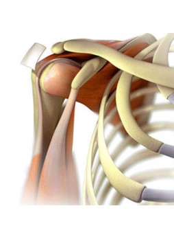 Тканевая матрица ортопедическая хирургия ArthroFlex®