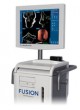 Система хирургической навигации для хирургической отоларингологии Fusion™ ENT оптом
