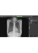 Система сбора данных для медицинских изображений для радиографии Nexus-DR™
