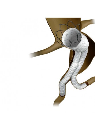 Стент-трансплантат брюшная аорта INCRAFT™ AAA оптом