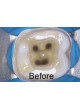 Ирригатор корневого канала EndoActivator® оптом