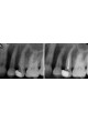 Лазер для стоматологии AT Fidelis оптом