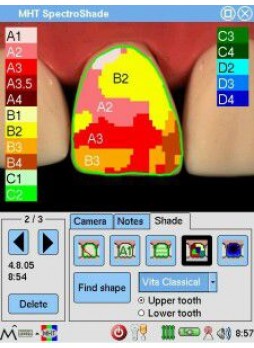 Колориметр для стоматологии SpectroShade™ Micro