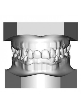 Модуль программного обеспечения для стоматологии Unitek™ TMP