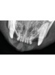 Интраоральный плоский детектор для стоматологической ветеринарной радиографии EzSensor 2.0 оптом