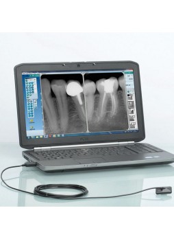 Интраоральный плоский детектор для стоматологической радиографии Opteo