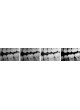 Интраоральный плоский детектор для стоматологической радиографии Schick 33 оптом