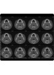 Программное обеспечение для обработки снимков зубов Invivo5 оптом