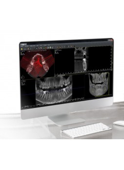 Программное обеспечение для обработки снимков зубов QuickVision 3D