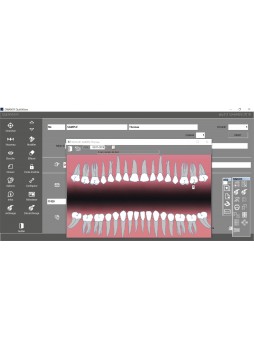Программное обеспечение для обработки снимков зубов Quickvision