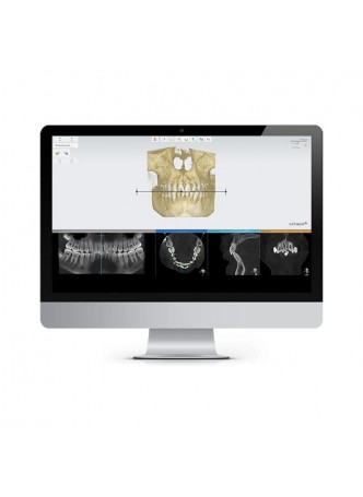 Клиническое программное обеспечение ORTHODONTIC PLANNER оптом