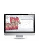 Клиническое программное обеспечение ORTHODONTIC PLANNER оптом