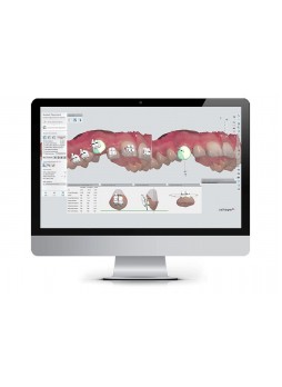 Ортодонтическое программное обеспечение ORTHO SYSTEM PREMIUM