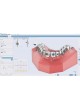 Ортодонтическое программное обеспечение Ortho Studio оптом