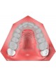 Ортодонтическое программное обеспечение Ortho Studio оптом