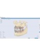 Ортодонтическое программное обеспечение Ortho Studio оптом