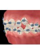 Программное обеспечение для ортодонтии Visage оптом